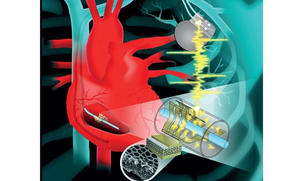Implantable MicroDevices for SelfCharging Pacemakers News