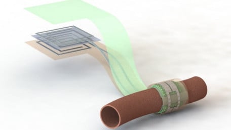 Wireless, Battery-Free, Biodegradable Blood Flow Sensor