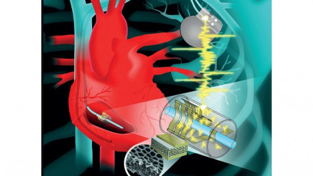 Implantable Micro-Devices for Self-Charging Pacemakers