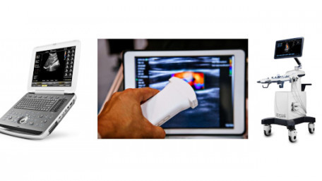 How to Choose the Right Battery-Charger IC for Ultrasound Point-of-Care Products